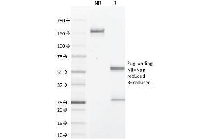 SDS-PAGE Analysis Purified GCDFP-15 Mouse Monoclonal Antibody (PIP/1571).