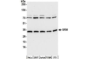 anti-Spermidine Synthase (SRM) (AA 252-302) antibody
