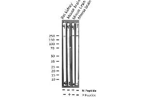 Western blot analysis of Phospho-WNK1 (Thr58) expression in various lysates
