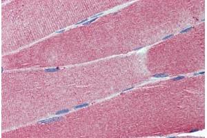 Human Skeletal Muscle: Formalin-Fixed, Paraffin-Embedded (FFPE) (Cell Adhesion Molecule 4 anticorps  (AA 73-83))