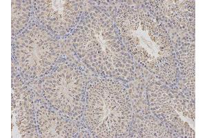 Immunohistochemistry (IHC) image for anti-Cytidine Deaminase (CDA) antibody (ABIN1871668) (CDA anticorps)