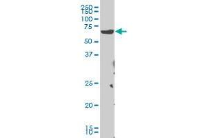CHEK2 monoclonal antibody (M04), clone 4F10 Western Blot analysis of CHEK2 expression in Hela S3 NE . (CHEK2 anticorps  (AA 1-543))