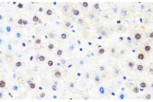 Immunohistochemistry of paraffin-embedded Rat liver using POLR2B Polyclonal Antibody at dilution of 1:100 (40x lens).