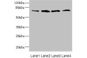 Western blot All lanes: DARS2 antibody at 16 μg/mL Lane 1: Mouse heart tissue Lane 2: Mouse liver tissue Lane 3: Mouse brain tissue Lane 4: Mouse skeletal muscle tissue Secondary Goat polyclonal to rabbit IgG at 1/10000 dilution Predicted band size: 73 kDa Observed band size: 73 kDa (FLRT3 anticorps  (AA 209-264))