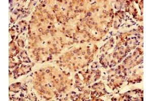 Immunohistochemistry of paraffin-embedded human pancreatic tissue using ABIN7147383 at dilution of 1:100 (CEP126 anticorps  (AA 559-670))