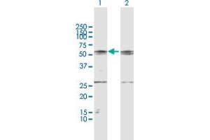 Western Blot analysis of GCK expression in transfected 293T cell line by GCK MaxPab polyclonal antibody.