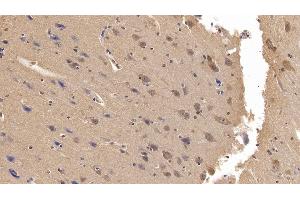 Detection of Ub in Human Cerebrum Tissue using Monoclonal Antibody to Ubiquitin (Ub)