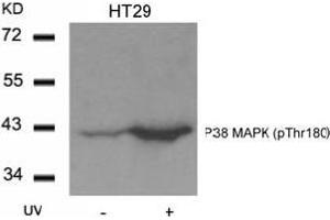 Image no. 1 for anti-Mitogen-Activated Protein Kinase 14 (MAPK14) (pThr180) antibody (ABIN197010) (MAPK14 anticorps  (pThr180))