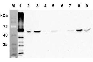 Western blot analysis of human FTO using anti-human FTO mAb (AG103)  at 1:1,000 dilution: 1.