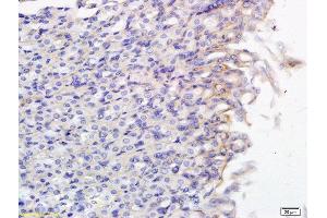 Formalin-fixed and paraffin embedded mouse small intestine labeled with Anti SLCO2B1 Polyclonal Antibody, Unconjugated  followed by conjugation to the secondary antibody and DAB staining (SLCO2B1 anticorps  (AA 531-630))