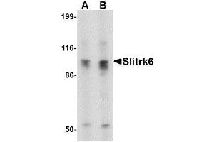 Image no. 1 for anti-SLIT and NTRK-Like Family, Member 6 (SLITRK6) (C-Term) antibody (ABIN1492200)