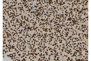 ABIN6276460 at 1/100 staining Mouse kidney tissue by IHC-P.