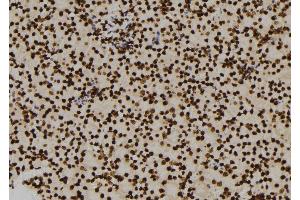 ABIN6276460 at 1/100 staining Mouse kidney tissue by IHC-P. (ENO1 anticorps  (C-Term))