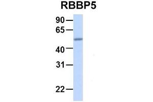 Host:  Rabbit  Target Name:  RBBP5  Sample Type:  Human Adult Placenta  Antibody Dilution:  1. (RBBP5 anticorps  (Middle Region))