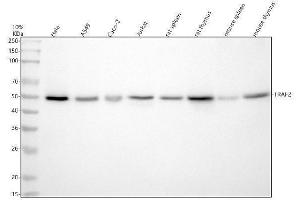 Western blot analysis of TRAF2 using anti-TRAF2 antibody (ABIN7606557).