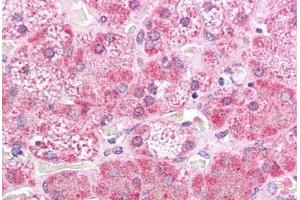 Human Adrenal: Formalin-Fixed, Paraffin-Embedded (FFPE)