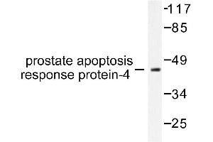 Image no. 1 for anti-PRKC, Apoptosis, WT1, Regulator (PAWR) antibody (ABIN271791) (PAWR anticorps)