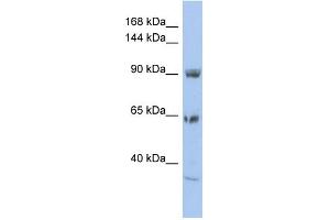 WB Suggested Anti-TPCN1 Antibody Titration:  0. (TPCN1 anticorps  (N-Term))