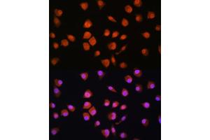 Immunofluorescence analysis of L929 cells using NPLOC4 Rabbit pAb (ABIN1681086, ABIN5664262, ABIN5664264 and ABIN6220175) at dilution of 1:100. (NPLOC4 anticorps  (AA 1-270))