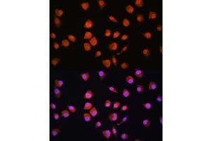 Immunofluorescence analysis of L929 cells using NPLOC4 Rabbit pAb (ABIN1681086, ABIN5664262, ABIN5664264 and ABIN6220175) at dilution of 1:100. (NPLOC4 anticorps  (AA 1-270))