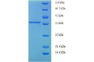 SDS-PAGE (SDS) image for Phosphatidylinositol Glycan Anchor Biosynthesis, Class X (PIGX) (AA 42-230), (partial) protein (His-SUMO Tag) (ABIN5711662)