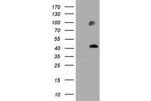 Image no. 2 for anti-Melanoma Antigen Family A, 3 (MAGEA3) antibody (ABIN1499253) (MAGEA3 anticorps)