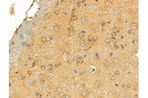 ABIN6258464 and ABIN6274298 at 1/100 staining Rat brain tissue by IHC-P.