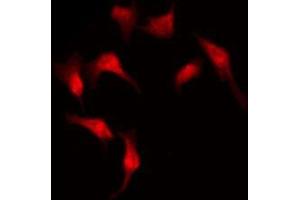 ABIN6273930 staining COLO205 by IF/ICC. (GPR176 anticorps  (C-Term))