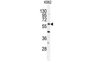 Western blot analysis of USP2 polyclonal antibody  in K-562 cell line lysates (35 ug/lane). (USP2 anticorps  (C-Term))