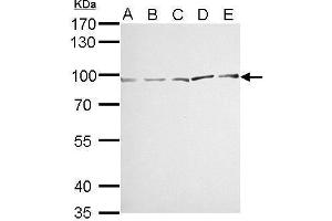 WB Image MVP/LRP antibody detects MVP protein by Western blot analysis.