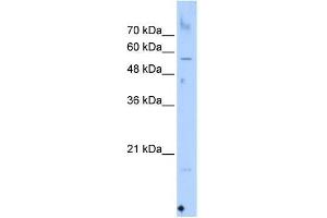 Western Blot showing SEPN1 antibody used at a concentration of 1-2 ug/ml to detect its target protein. (SEPN1 anticorps  (C-Term))