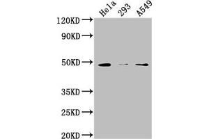 Western Blot Positive WB detected in: Hela whole cell lysate, 293 whole cell lysate, A549 whole cell lysate All lanes: NXN antibody at 1:2000 Secondary Goat polyclonal to rabbit IgG at 1/50000 dilution Predicted band size: 49, 21, 37 kDa Observed band size: 49 kDa (NXN anticorps  (AA 155-435))