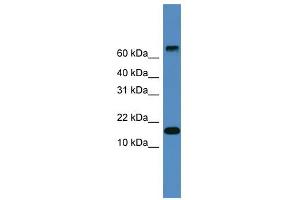WB Suggested Anti-CST9 Antibody Titration: 0. (CST9 anticorps  (Middle Region))