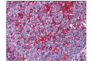 Human Tonsil: Formalin-Fixed, Paraffin-Embedded (FFPE) (ARL6IP5 anticorps  (C-Term))