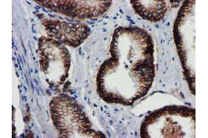 Image no. 13 for anti-Makorin Ring Finger Protein 1 (MKRN1) antibody (ABIN1499486)