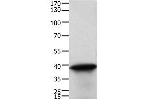 Western Blot analysis of Human cervical cancer tissue using TPM2 Polyclonal Antibody at dilution of 1:600 (TPM2 anticorps)