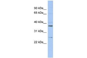 WB Suggested Anti-ZFAND6 Antibody Titration: 0. (ZFAND6 anticorps  (Middle Region))