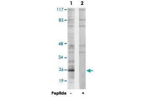 Western blot analysis of extracts from Jurkat cells, using PPP1R2 polyclonal antibody . (PPP1R2 anticorps  (Ser120, Ser121))