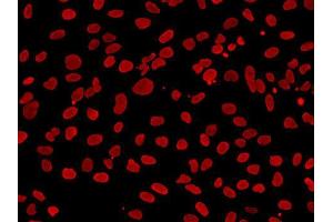 Immunofluorescence analysis of A549 cell using KDM3A antibody.