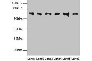 Western blot All lanes: FBXO24 antibody at 1 μg/mL Lane 1: Mouse gonadal tissue Lane 2: Mouse kidney tissue Lane 3: A549 whole cell lysate Lane 4: 293T whole cell lysate Lane 5: Jurkat whole cell lysate Lane 6: MCF-7 whole cell lysate Secondary Goat polyclonal to rabbit IgG at 1/10000 dilution Predicted band size: 65, 37, 70, 64 kDa Observed band size: 65 kDa (FBXO24 anticorps  (AA 1-200))