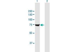 anti-Insulin-Like Growth Factor 2 mRNA Binding Protein 2 (IGF2BP2) (AA 1-598) antibody