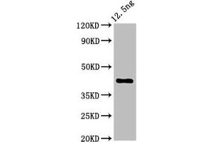 Western Blot Positive WB detected in Recombinant protein All lanes: ZAR1 antibody at 5. (Zygote Arrest 1 anticorps  (AA 167-278))