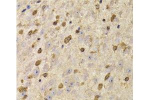Immunohistochemistry of paraffin-embedded Mouse brain using QKI Polyclonal Antibody at dilution of 1:100 (40x lens). (QKI anticorps)
