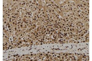 ABIN6279080 at 1/100 staining Human liver tissue by IHC-P. (ADAM33 anticorps  (Internal Region))