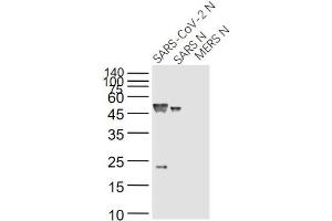 Lane 1: SARS-CoV-2 N Protein; Lane 2: Recombinant SARS N (1-422) protein; Lane 3: MERS N protein probed with SARS Nucleocapsid Protein (14B3D) Monoclonal Antibody, Unconjugated (bsm-49134M) at 1:1000 dilution and 4˚C overnight incubation. (SARS-Coronavirus Nucleocapsid Protein (SARS-CoV N) anticorps)