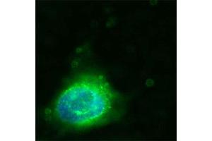 Human Melanoma cell line C 32 was cultured overnight on round cover slides placed in a 24 well tissue culture plate.