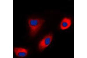 Immunofluorescent analysis of DAB1 staining in MCF7 cells.