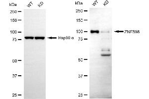 Western blotting analysis using ZNF598 antibody (ABIN7800898).
