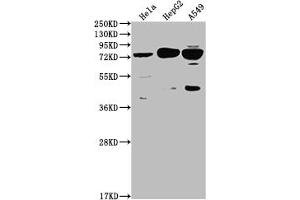 Western Blot Positive WB detected in: Hela whole cell lysate, HepG2 whole cell lysate, A549 whole cell lysate All lanes: HTR2C antibody at 1:2000 Secondary Goat polyclonal to rabbit IgG at 1/50000 dilution Predicted band size: 52, 29 kDa Observed band size: 75 kDa (Recombinant HTR2C anticorps)