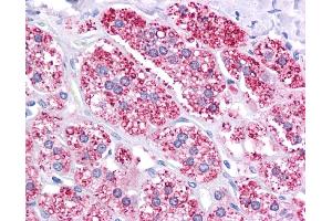 ABCB1 antibody was used for immunohistochemistry at a concentration of 4-8 ug/ml. (ABCB1 anticorps)
